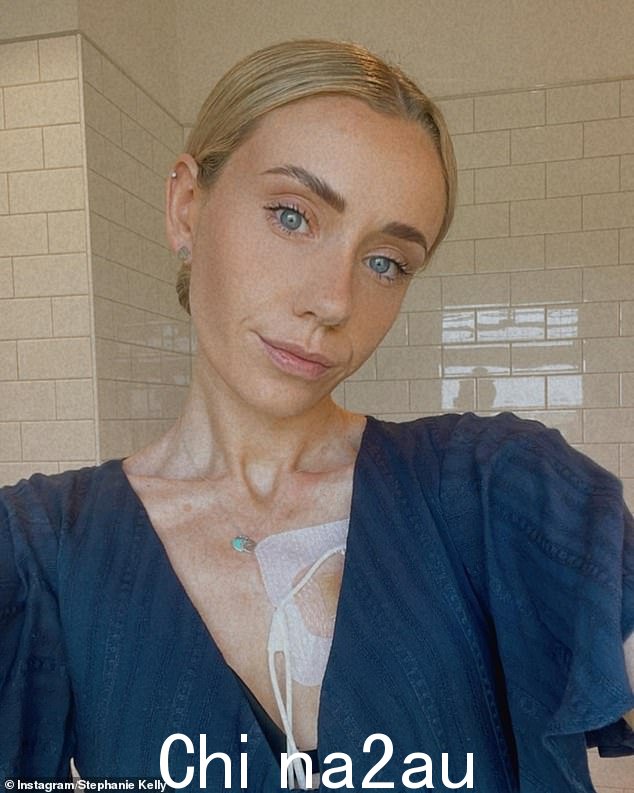 坠机让凯利女士无法进食,所以她唯一能获得营养的方法就是通过喂食管