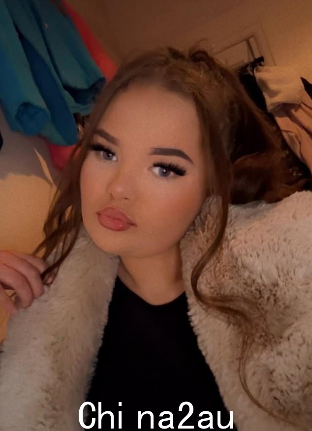 Sophie Russon,20 岁,从 w残骸并在医院中仍然受重伤