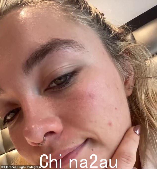 准备奥斯卡! Florence Pugh 将粉丝关在门外。人们看到她在皮肤上完成了工作,因此她在奥斯卡金像奖颁奖典礼上大放异彩