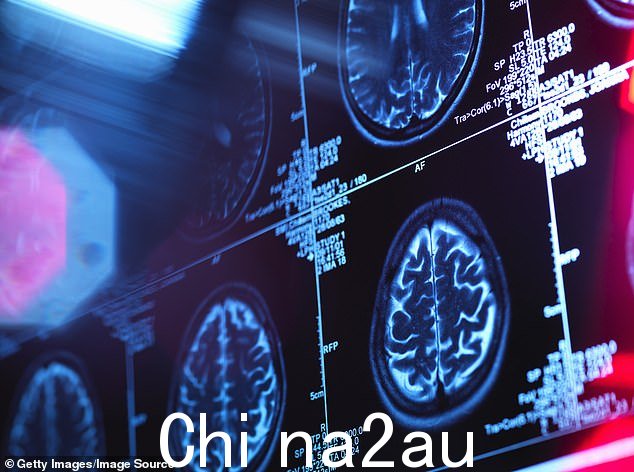 我要解释一下 la 背后到底发生了什么测试健康新闻故事 - 从位于痴呆症研究核心的“可能被伪造的”数据开始