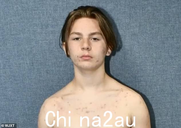 公开的照片显示 Fucci 的妈妈y 10, 2021 - Tristyn 的尸体被发现布满刀伤的第二天 - 显示他的胸部布满划痕