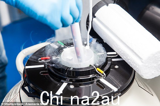 用于精子捐赠过程的液氮低温罐的文件图像