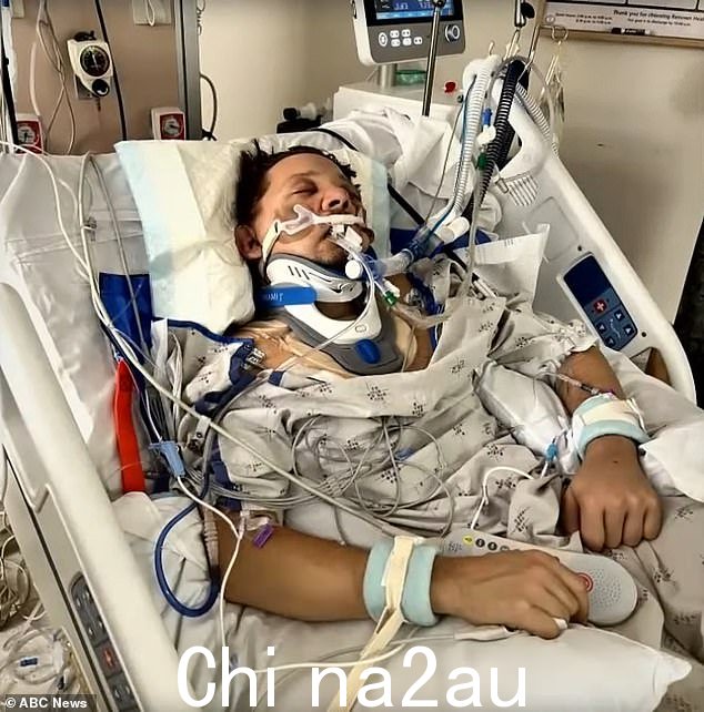 在元旦那场可怕的致命事故中,他骨折了 30 处,肺部塌陷,肝脏被一根破碎的肋骨刺穿