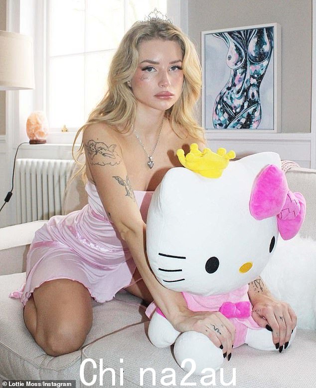 Lottie Moss 发誓要去除她脸上的纹身,四个月前她醉酒后在眼睛下方纹上了“情人”这个词