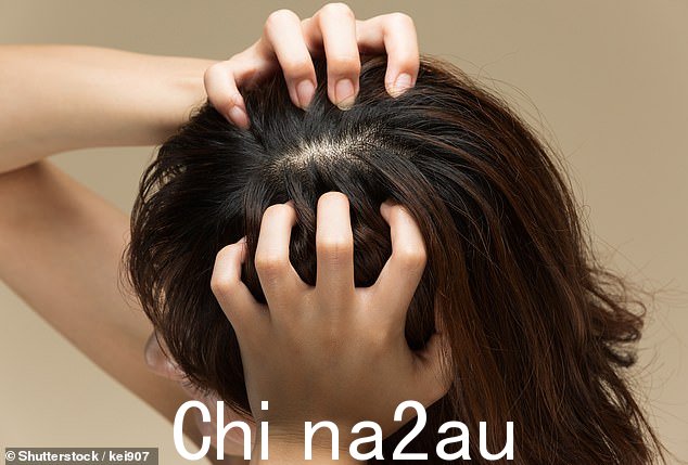 头皮癌很常见,但通常会被忽视,因为人的头发会阻止生长迹象(档案照片)