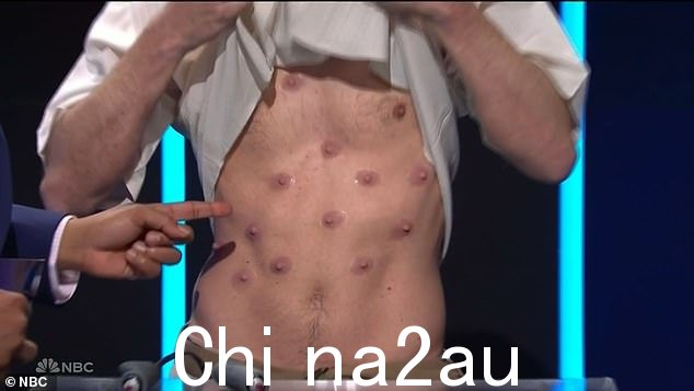 Yikes:Matt 有一次抓挠了他的腹部,露出了他的胸部,上面有多个乳头,震惊的主持人继续想知道为什么 Carmen 会被他吸引