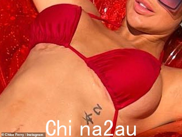 现在看看我:虽然快照下的大多数评论都在欣赏这位尤物和她完美无瑕的身材,但一位粉丝引发了对她手术后遗症的担忧