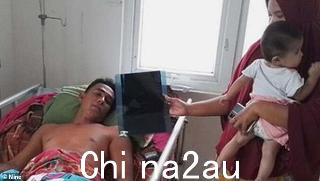 渔夫 Edi Ron(如图)在所谓的袭击事件发生后正在护理一系列伤势,包括骨折、50 处缝合和疼痛的神经损伤