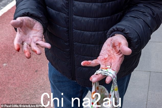 Dawon 先生在一位摄影师面前摔倒在路边,手和膝盖都被割伤了