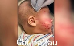 澳洲华裔婴儿托儿所抓获20多处血迹！家长伤心欲绝泪流满面坚信：这不是意外（图）