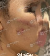疑男友出轨，手机存不雅视频，悉尼华裔女学生争执中遭家暴！掐脖子打了十多个耳光，“我只能一直喊救命！” （相片）