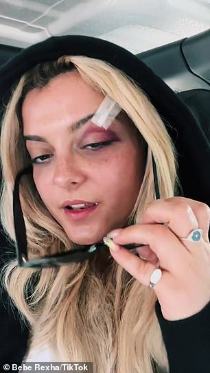 这名艺人的全名是 Bleta Rexha,事发后身上有很深的瘀伤和缝线