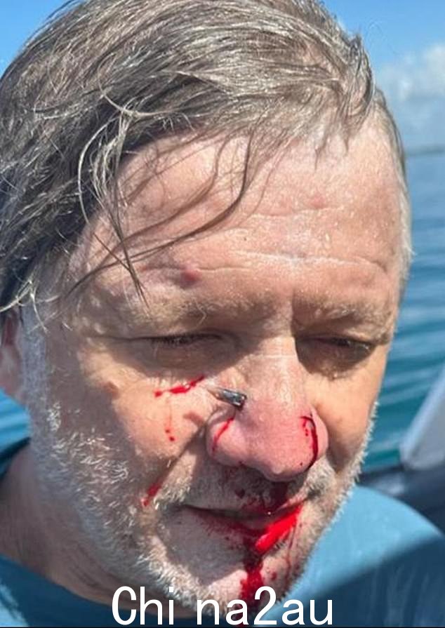 珀斯冲浪者 Steve Kazic 的鼻子上周六被长嘴鱼的长嘴刺穿（如图，Kazic 先生受伤后的瞬间）