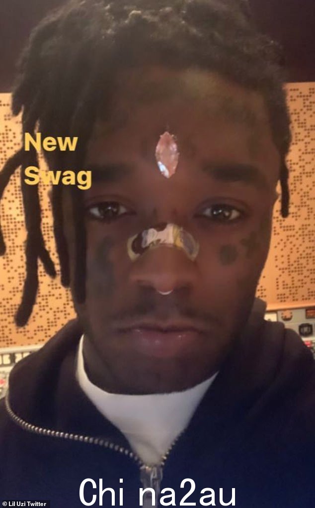 Flashy:早在 2021 年 1 月,Lil Uzi 就透露他们的额头上刺有一颗价值 2400 万美元的粉红钻石