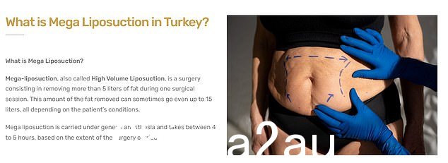 Istanbul Care 声称可以在抽脂手术中去除多达 15 升的脂肪。但英国严格的吸脂规则意味着一次不能去除超过三升的脂肪
