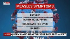 新南威尔士州确诊的新麻疹病例在感染者访问多个地点后引发新的健康警报
