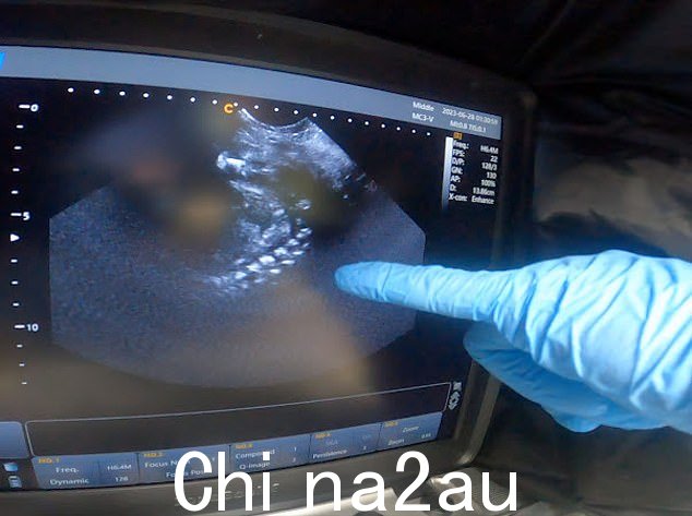 喜悦!超声波显示 Lalia 怀孕了,据信这是此类设备首次在英国圈养的雪豹身上使用
