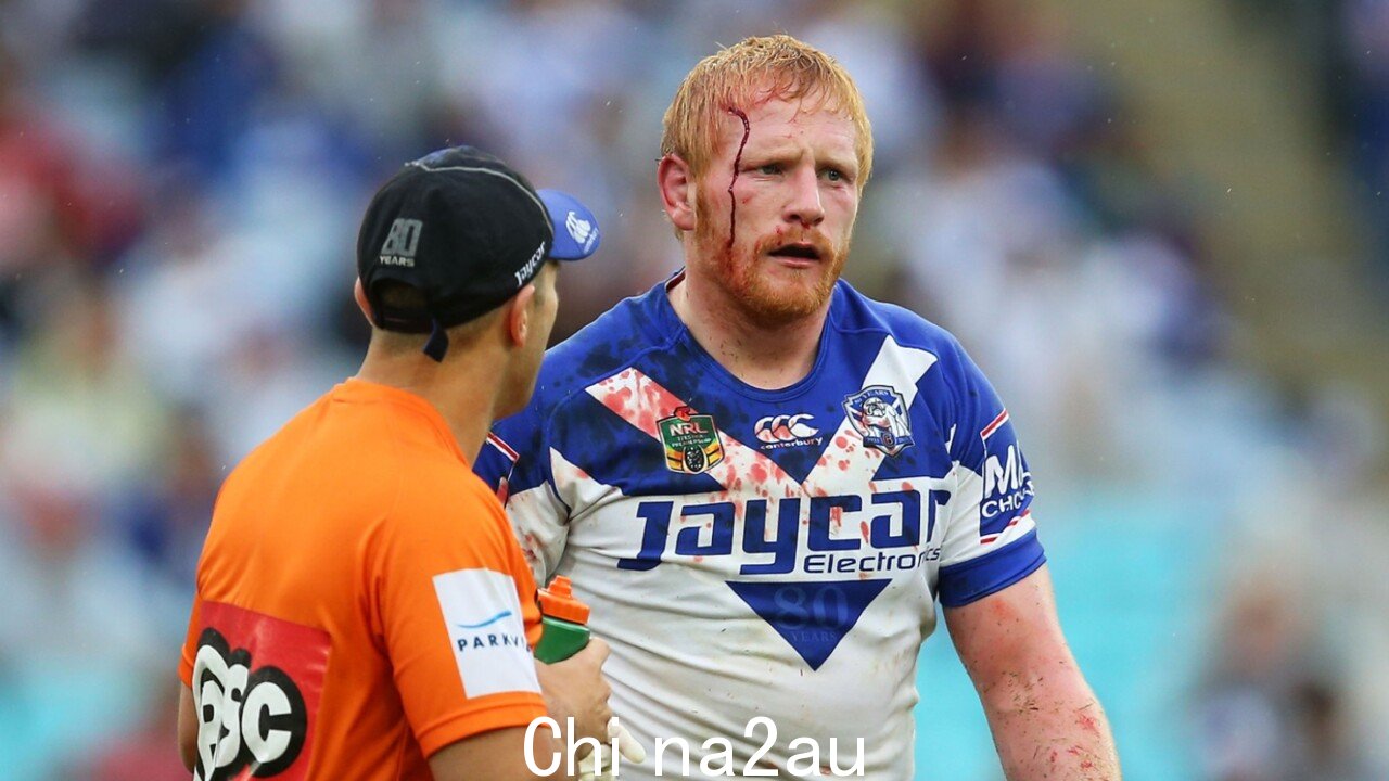 NRL 脑震荡暂停规则是“朝着正确方向迈出的一步”,但“还需要做更多的事情”” fetchpriority=