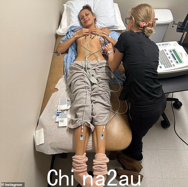 保持积极态度:一张照片显示这位走秀明星赤裸上身,躺在医疗环境的床上接受治疗,露出柔和的微笑