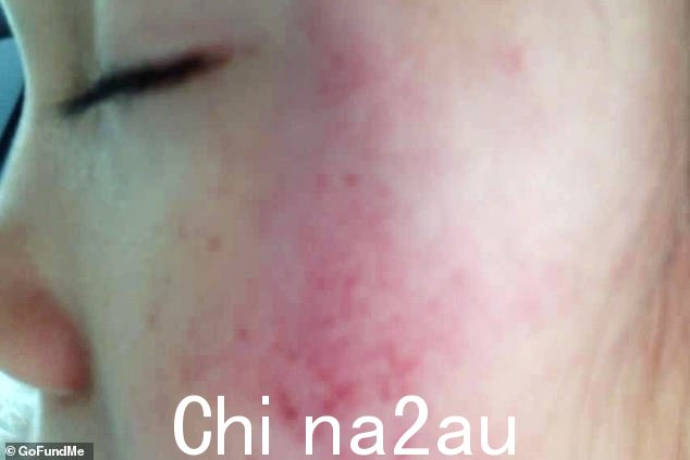 Lil Tay 因被指控受到父亲的身心虐待而卷入激烈的争议