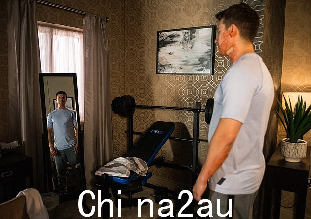 绝望时刻:后来,瑞安收到了一条名叫盖伊的男子发来的消息,表示愿意付费购买一些私人照片。 Ryan 脱掉上衣,小心地隐藏伤疤,上传了一些照片