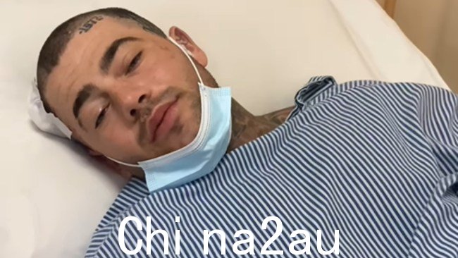 Benji Ward 在社交媒体上表示,他正在从成功的康复中恢复过来。在巴厘岛发生迎面相撞事故后接受手术。图片:Instagram