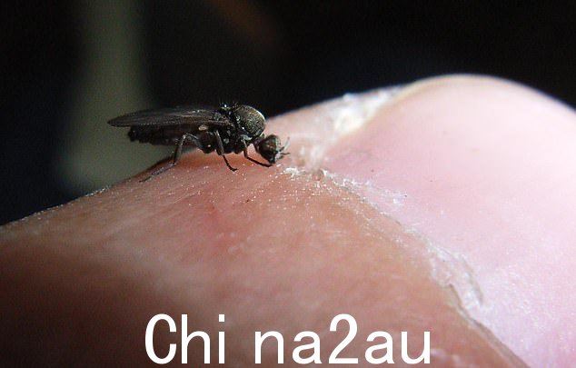 雌性沙蝇会叮咬皮肤并流血。上图是新西兰人拇指上的沙蝇品种