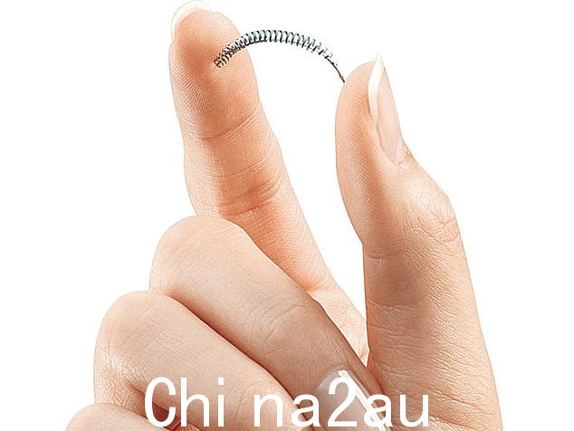 Essure 线圈是一种插入女性输卵管以防止怀孕的金属装置,已于 2017 年从英国市场撤出