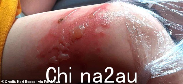 奥罗拉(Aurora)擦过巨大的猪草——尽管她穿着紧身裤——植物的汁液已经穿过了