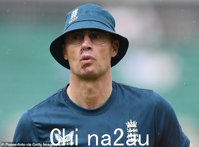 安德鲁 '弗雷迪' 弗林托夫 (Andrew 'Freddie' Flintoff) 在去年发生恐怖车祸后六周前仍然遮住了脸,他的前英格兰板球队队友声称