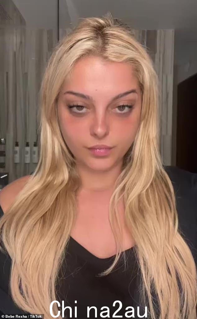 感到焦虑:Bebe Rexha 周一在社交媒体上承认对周二在新泽西州参加 MTV 音乐录影带颁奖典礼感到焦虑