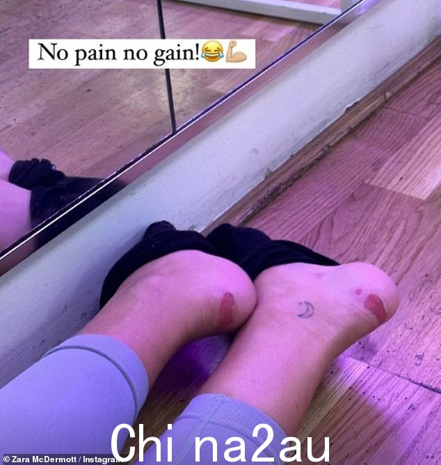 痛苦:周四,扎拉分享了一张她脚起泡的照片,当时她正在为即将到来的节目进行训练