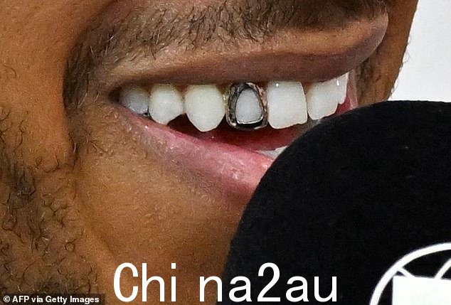 就是这样:这位热爱时尚的一级方程式王牌在铃鹿国际赛车场回答问题时展示了独特的金牙格栅