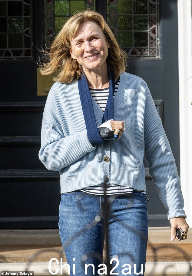 菲奥娜·布鲁斯 (Fiona Bruce) 今天在最近的一次事故中从马上摔下来,照片中她的眼睛被打青,手臂上吊着吊带