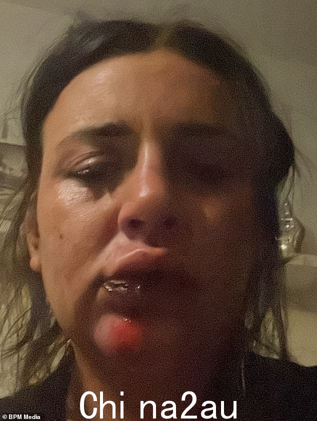 当时 29 岁的她遭到嫉妒的男友的长期恶毒攻击