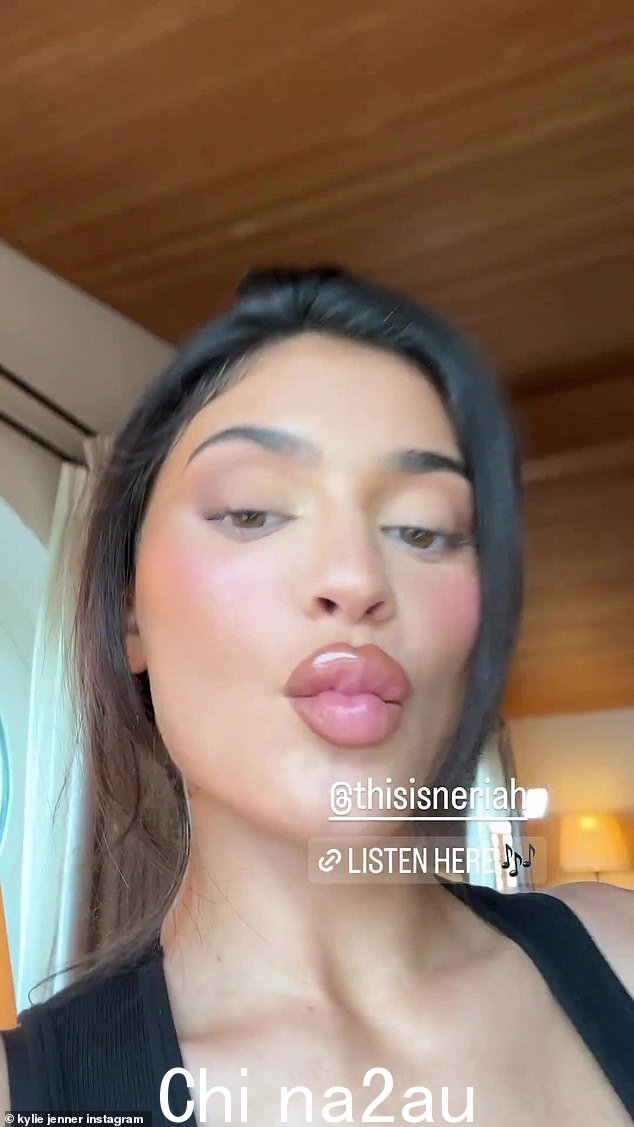 凯莉·詹纳 (Kylie Jenner) 对她著名的撅嘴的嗜好似乎是一种非常现代的现象。她经常在 Instagram 上向全世界展示她性感的嘴唇