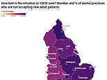 透露:根据休克分析,80% 的 NHS 牙医已经向新患者关上了大门……那么您也是其中之一吗?