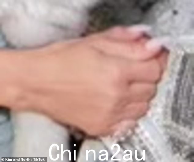 粉丝们迅速在社交媒体上活跃起来,并注意到这张图片让金看起来右手上有两个拇指