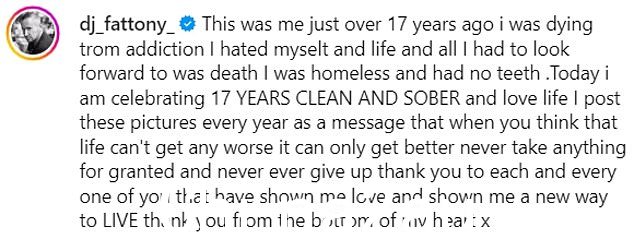 托尼在与他的 Instagram 粉丝分享这篇坦率的帖子时写道:“这就是 17 年前的我,我因毒瘾而濒临死亡,我讨厌自己、生活以及我所期待的一切就是死亡。我无家可归,没有牙齿。'