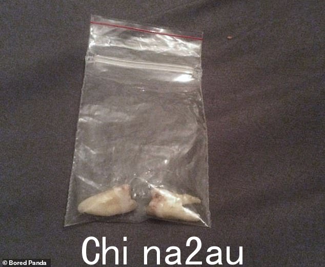 运行!在其他地方,有人在她刚搬进的新家里发现了一袋陌生人的牙齿