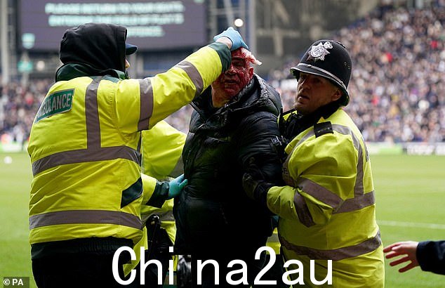 警察移除风扇在看台冲突中头部被割伤的人