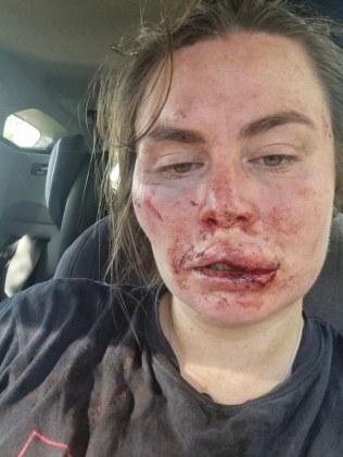 Sissy Austin 在巴拉瑞特跑步时遭到自制武器袭击。图片：Sissy Austin