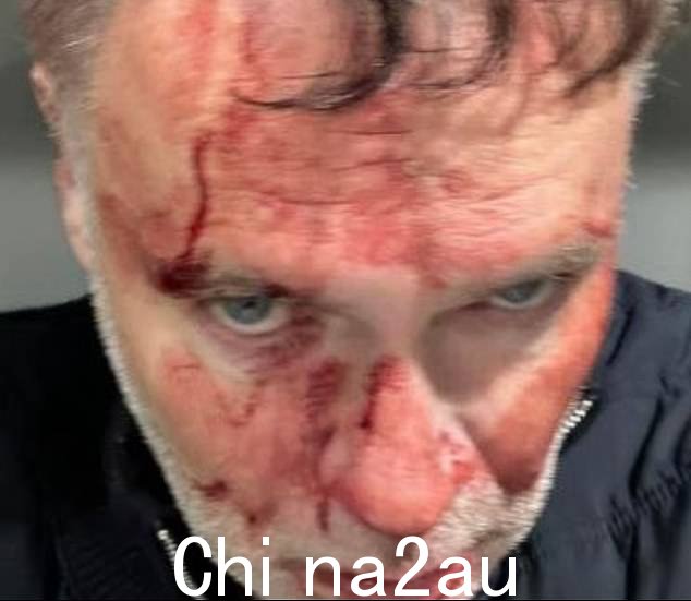 Hugo Boyle,56 岁(如图)被锤子袭击后头部和腿部受伤,血流不止