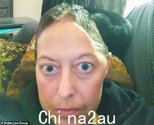 事实上,麦克卢尔患有严重中风,需要进行紧急脑部手术