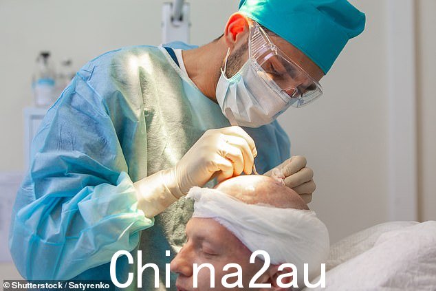 任何在英格兰运营的头发手术中心都必须在护理质量委员会注册(库存图片)