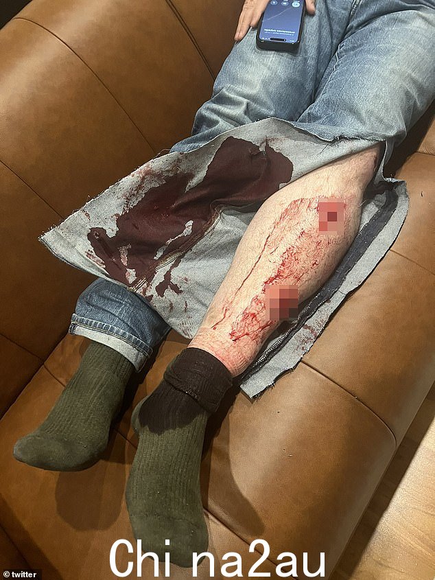 他的腿上也有流血,牛仔裤都湿透了