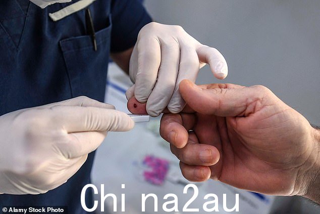 根据两项具有里程碑意义的试验,牛津大学和伦敦大学学院的研究人员将使用廉价的测试来检测血液中与疾病和其他形式的痴呆症相关的蛋白质