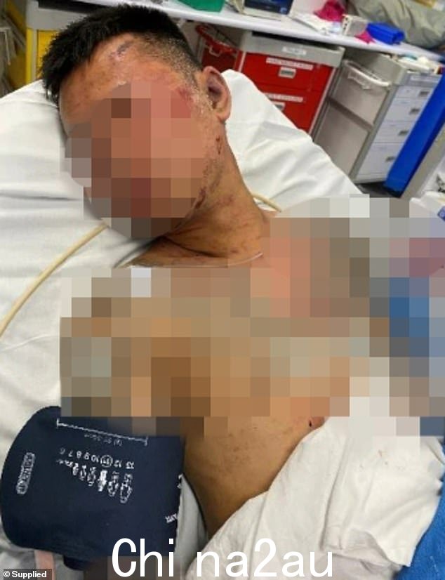 去年 2 月的痛苦经历中,据称男性受害者的手指和脚趾被切断,其中一名男子的头被踩踏