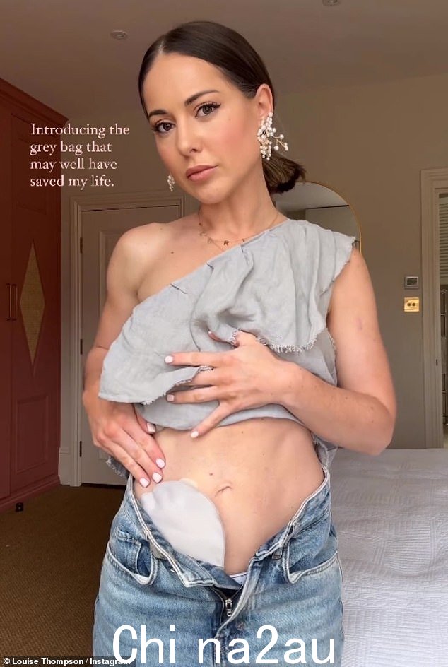 Louise Thompson 透露,在经历了多年的健康问题和医院就诊后,她如何安装了一个“救生”造口袋