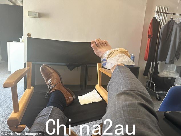 他分享了一张演员将脚放在导演椅上的照片,右脚受伤的脚踝上敷着冰袋。